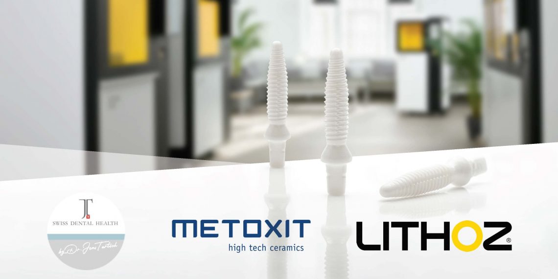Lithoz, Metoxit ve Dr. Jens Tartsch arasında İş ortaklığı yoluyla seramik diş implantları üretmek için 3D baskı projesi