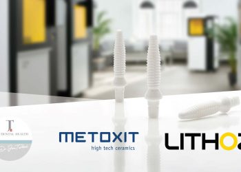 Lithoz, Metoxit ve Dr. Jens Tartsch arasında İş ortaklığı yoluyla seramik diş implantları üretmek için 3D baskı projesi