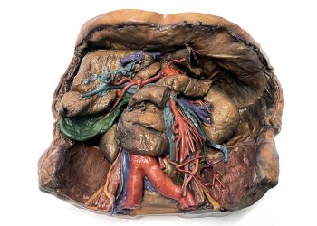 Geleneksel model yapımcıları, Mimaki 3DUJ serisini kullanarak tıp eğitimini ilerletiyor