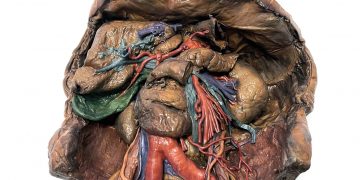 Geleneksel model yapımcıları, Mimaki 3DUJ serisini kullanarak tıp eğitimini ilerletiyor