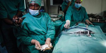 UP akademik öncüleri 3D baskılı kemikler kullanarak ilk orta kulak naklini yaptı