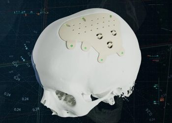 Materialise, kişiye özel PEEK implantlarla CMF portföyünü genişletiyor