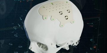 Materialise, kişiye özel PEEK implantlarla CMF portföyünü genişletiyor